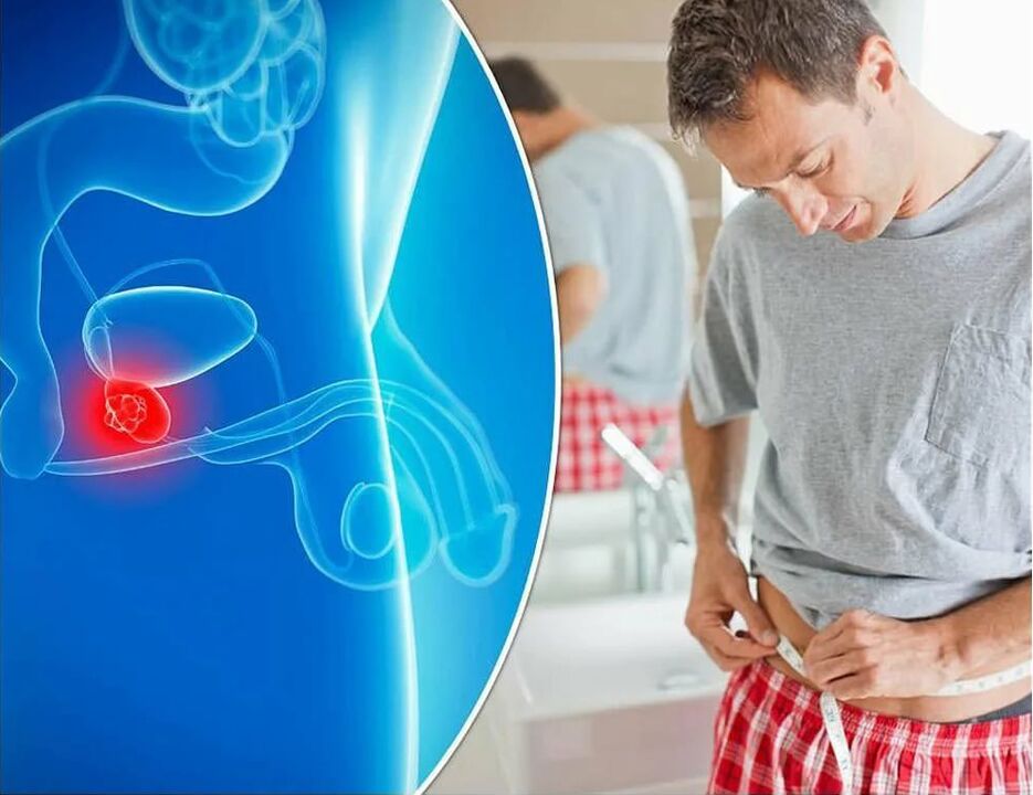 Symptome und Ursachen einer Prostataentzündung