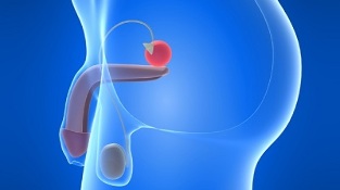 Prostatamassage zur Vorbeugung von Prostatitis